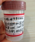 一次性医疗尿杯，大便杯，痰杯，寻找包工包料的厂家