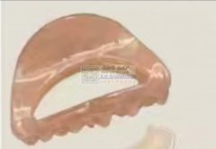 现需寻找有如图塑料抓夹模具的工厂，有订单