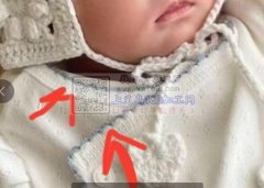 寻做缺牙机工艺的工厂，有做的请联系